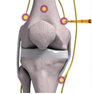 Knee Tissue