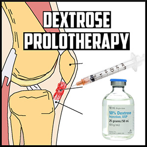 prolotherapy