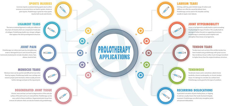 prolotherapy