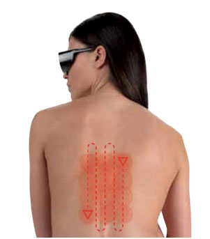 MLS Laser Therapy