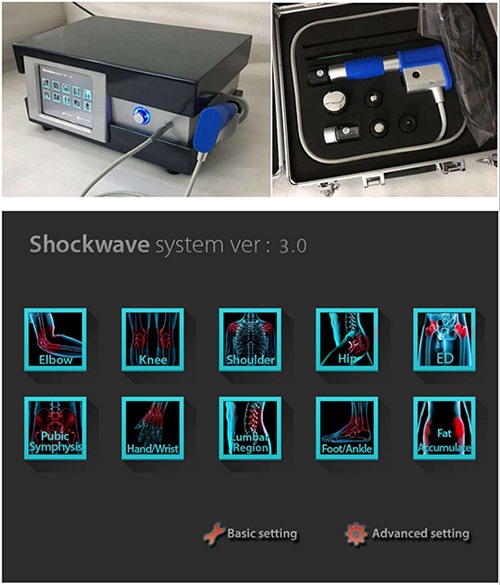 Extracorporeal Shock Wave Therapy: How Does it Help Your Muscles and Bones?